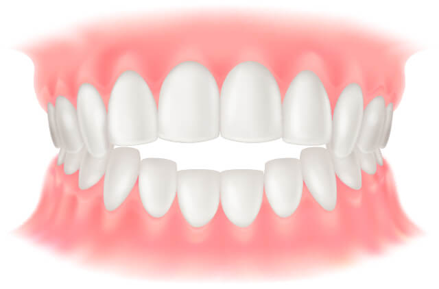 開咬(かいこう)