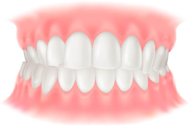 交叉咬合(こうさこうごう)